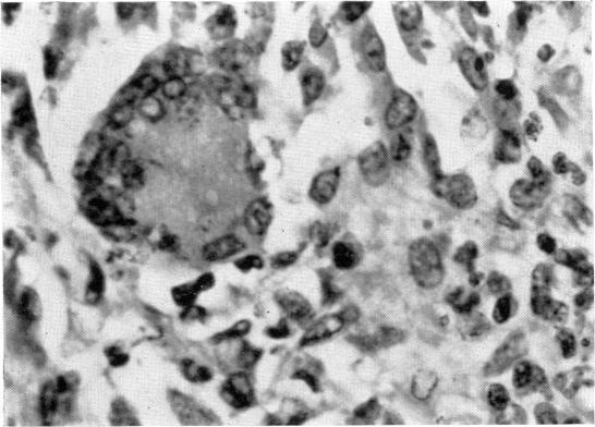 https://cdn.ncbi.nlm.nih.gov/pmc/blobs/486b/1712737/679c8caad7a6/clinexpimmunol00382-0023-b.jpg