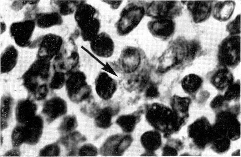 https://cdn.ncbi.nlm.nih.gov/pmc/blobs/486b/1712737/d89837702cc6/clinexpimmunol00382-0019-b.jpg