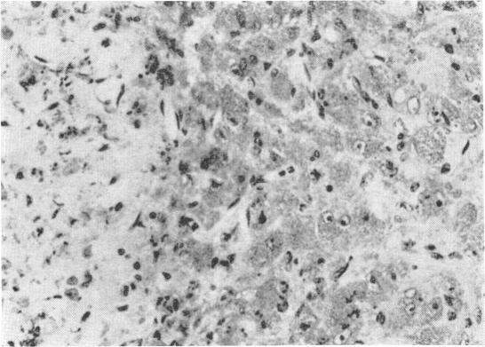 https://cdn.ncbi.nlm.nih.gov/pmc/blobs/486b/1712737/ee7550a861a4/clinexpimmunol00382-0015-a.jpg