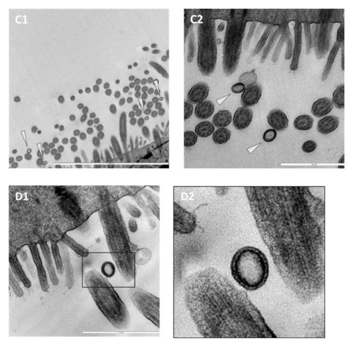 https://cdn.ncbi.nlm.nih.gov/pmc/blobs/4873/8618481/5ca995d0fc1b/microorganisms-09-02407-g003.jpg