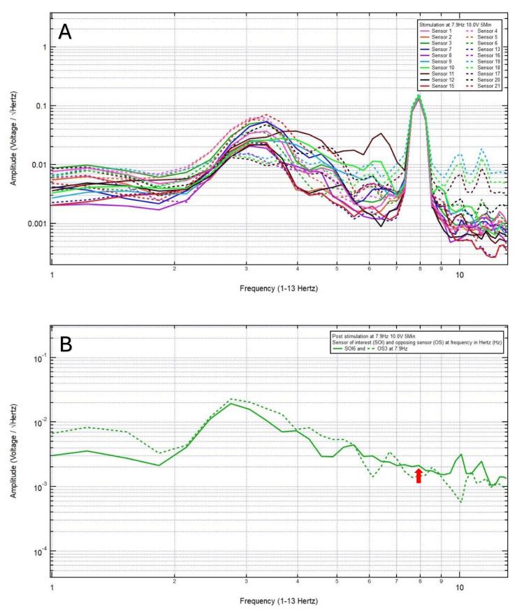 https://cdn.ncbi.nlm.nih.gov/pmc/blobs/4876/12101138/497c26cd602e/cureus-0017-00000084653-i03.jpg