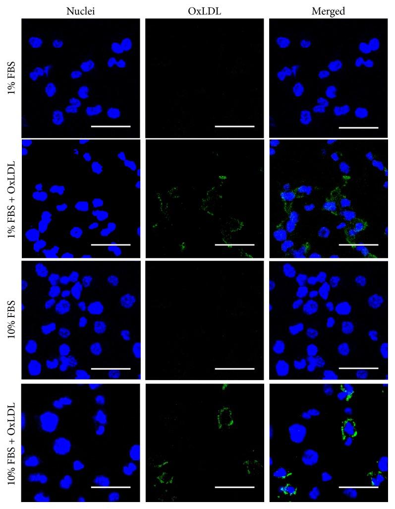 https://cdn.ncbi.nlm.nih.gov/pmc/blobs/4876/6282138/4568d1cc4c30/BMRI2018-3739251.002.jpg