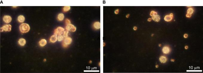 https://cdn.ncbi.nlm.nih.gov/pmc/blobs/487b/9889553/c3882a89d789/fcimb-12-1091341-g003.jpg