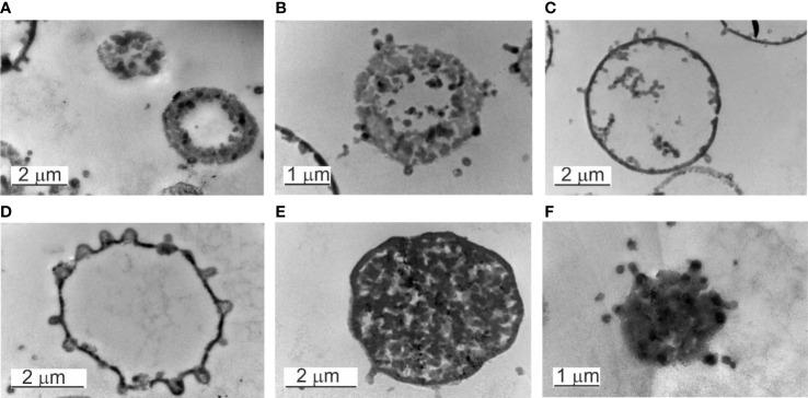https://cdn.ncbi.nlm.nih.gov/pmc/blobs/487b/9889553/fb4c267b9fdb/fcimb-12-1091341-g006.jpg