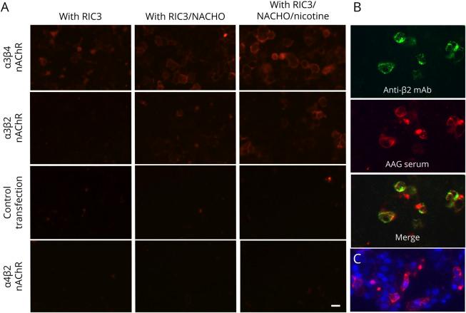 https://cdn.ncbi.nlm.nih.gov/pmc/blobs/4891/8969289/3d6ed9c263c7/NEURIMMINFL2021039471f1.jpg