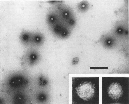 https://cdn.ncbi.nlm.nih.gov/pmc/blobs/4893/356116/99ae250b3b16/jvirol00279-0025-a.jpg