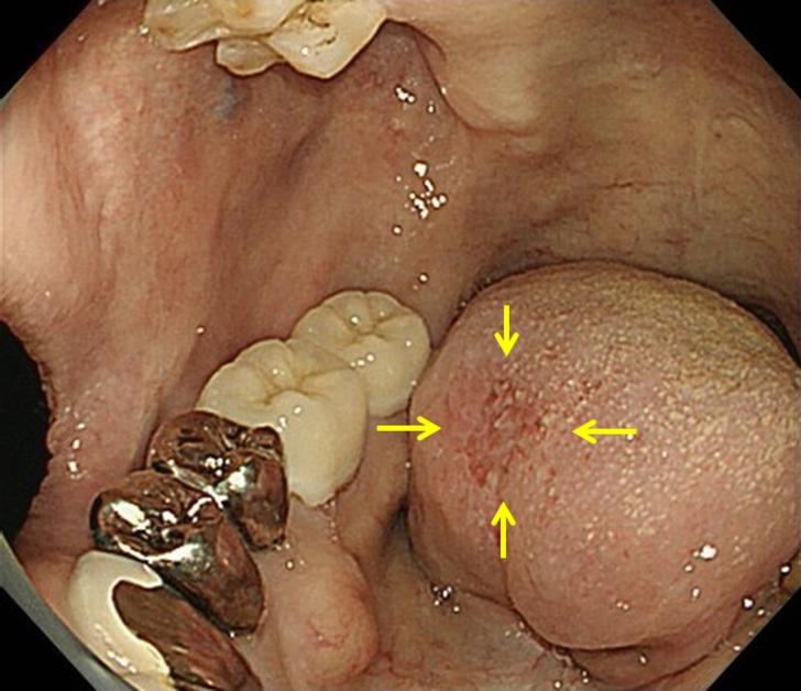 https://cdn.ncbi.nlm.nih.gov/pmc/blobs/489b/6346765/d5a147aa6cf5/577_Fig2.jpg