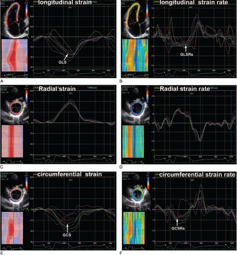 https://cdn.ncbi.nlm.nih.gov/pmc/blobs/48a1/4979818/ceefcaf469ab/medi-95-e4426-g001.jpg