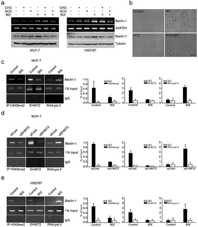 https://cdn.ncbi.nlm.nih.gov/pmc/blobs/48a1/5129971/00feb11e1840/oncotarget-07-39796-g002.jpg