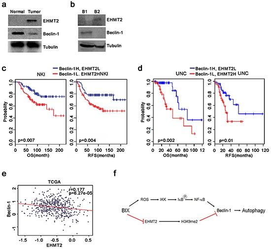 https://cdn.ncbi.nlm.nih.gov/pmc/blobs/48a1/5129971/05a772bd92e3/oncotarget-07-39796-g006.jpg