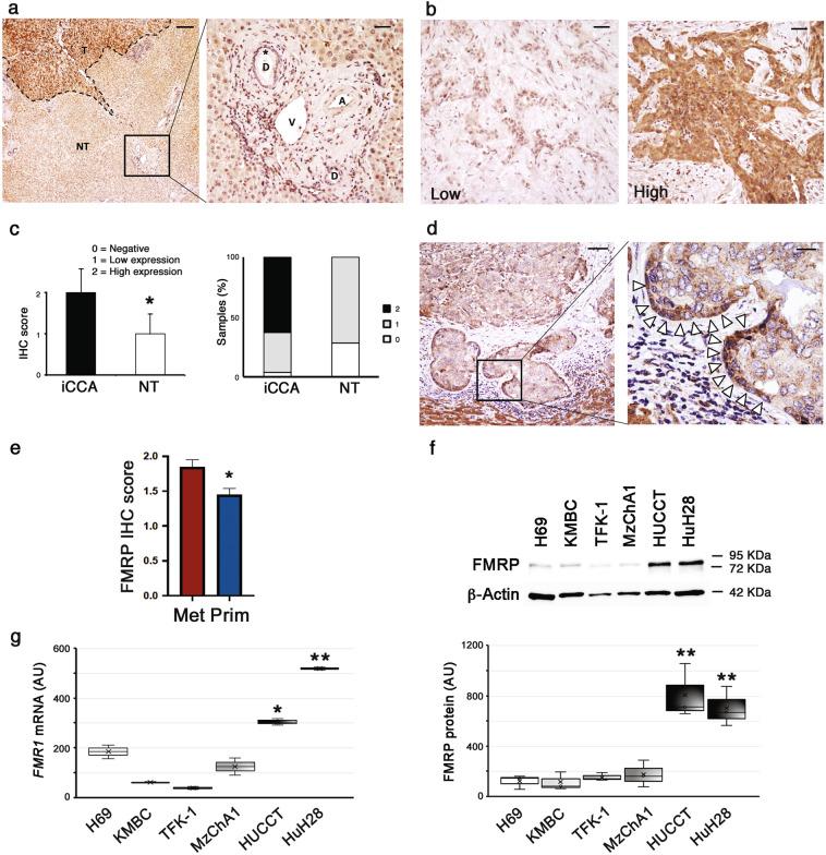 https://cdn.ncbi.nlm.nih.gov/pmc/blobs/48a3/8195741/bcf4c0413aa1/41388_2021_1824_Fig1_HTML.jpg