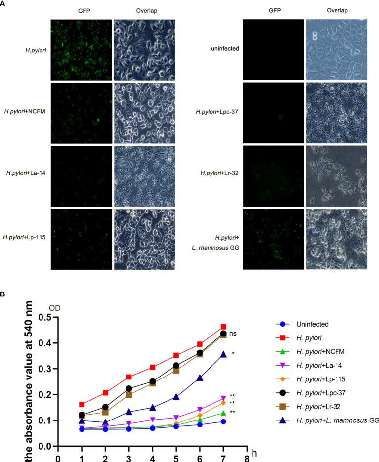 https://cdn.ncbi.nlm.nih.gov/pmc/blobs/48a5/10445763/1535dbcdac0b/fcimb-13-1196084-g002.jpg