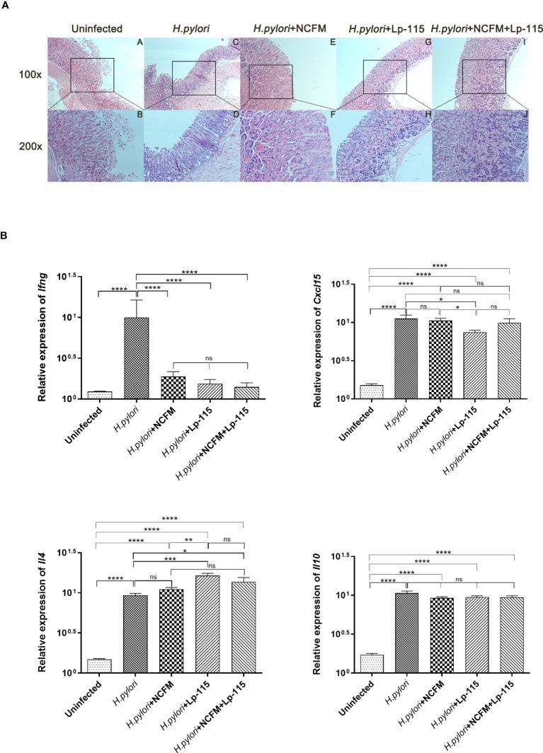 https://cdn.ncbi.nlm.nih.gov/pmc/blobs/48a5/10445763/633f92304b41/fcimb-13-1196084-g004.jpg