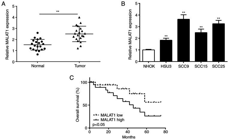 https://cdn.ncbi.nlm.nih.gov/pmc/blobs/48a5/7471703/2acca4f755d7/ol-20-05-12024-g00.jpg