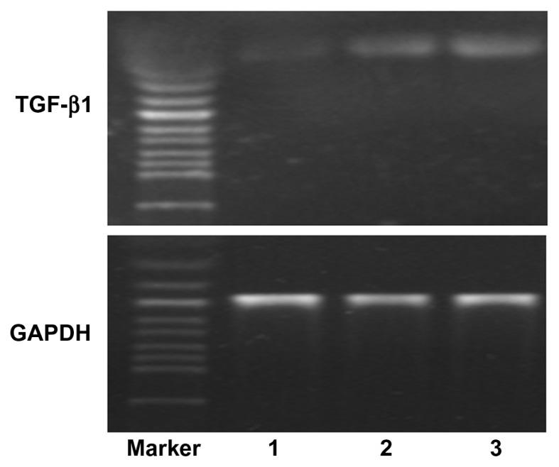 https://cdn.ncbi.nlm.nih.gov/pmc/blobs/48ae/3310408/6be1fea3502e/ijn-7-1297f11.jpg