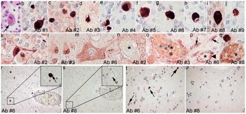 https://cdn.ncbi.nlm.nih.gov/pmc/blobs/48b1/4182568/73c96b911e3e/pone.0108861.g002.jpg