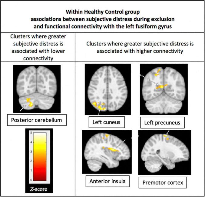 https://cdn.ncbi.nlm.nih.gov/pmc/blobs/48b2/9011186/67cc73ecaa4d/fpsyt-13-687052-g005.jpg