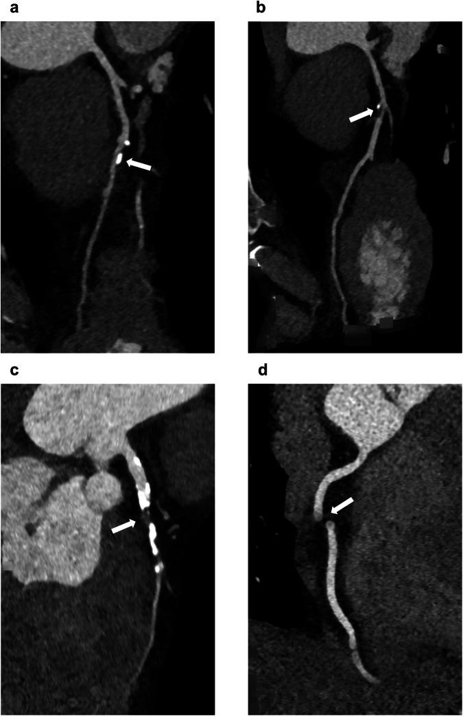 https://cdn.ncbi.nlm.nih.gov/pmc/blobs/48b8/11836176/038089126408/330_2024_11308_Fig2_HTML.jpg