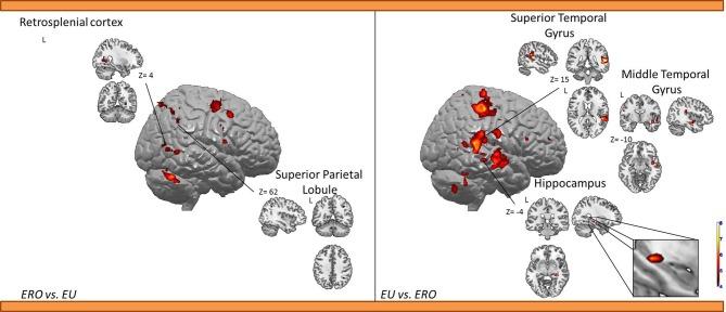 https://cdn.ncbi.nlm.nih.gov/pmc/blobs/48b9/3960510/b958d0e73119/fnhum-08-00150-g0003.jpg