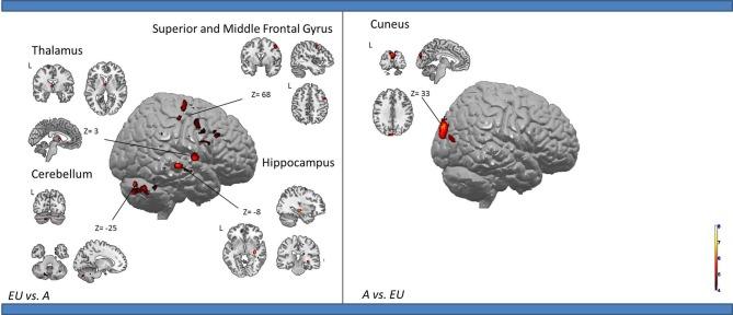 https://cdn.ncbi.nlm.nih.gov/pmc/blobs/48b9/3960510/e31168bdb485/fnhum-08-00150-g0002.jpg