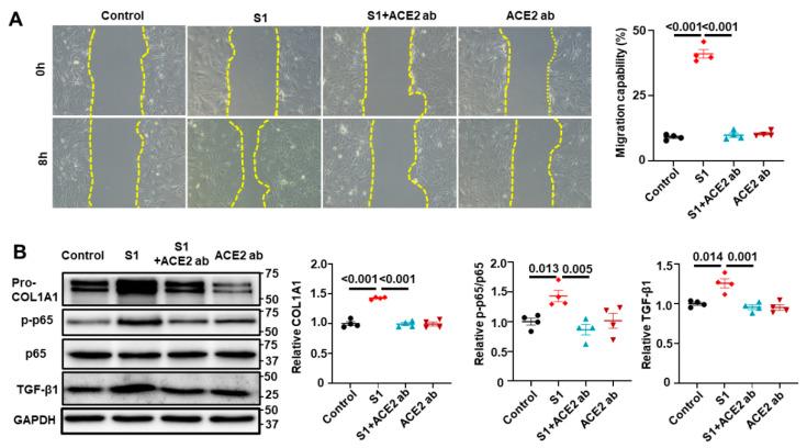 https://cdn.ncbi.nlm.nih.gov/pmc/blobs/48be/11353017/17ea84a41d33/cells-13-01331-g007.jpg
