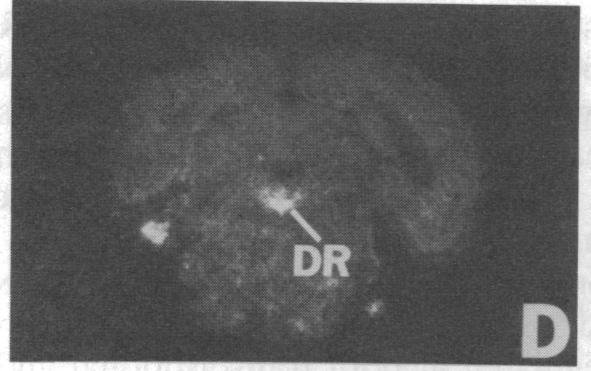 https://cdn.ncbi.nlm.nih.gov/pmc/blobs/48c1/287032/46fd63c9fa4d/pnas00248-0414-d.jpg