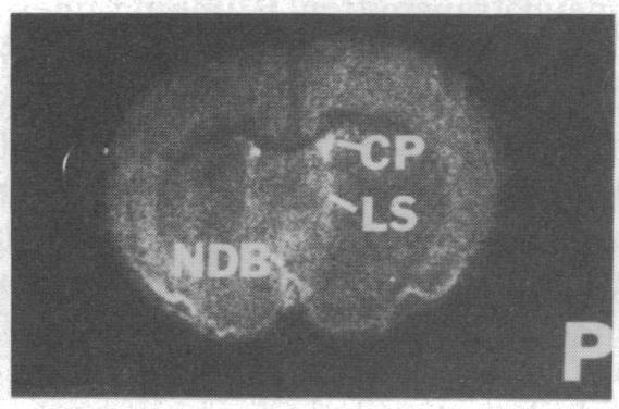 https://cdn.ncbi.nlm.nih.gov/pmc/blobs/48c1/287032/5df793dbddea/pnas00248-0414-p.jpg