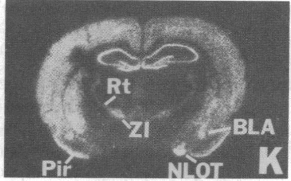 https://cdn.ncbi.nlm.nih.gov/pmc/blobs/48c1/287032/fa28e4aaef07/pnas00248-0414-l.jpg