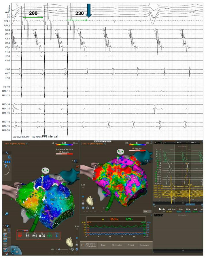 https://cdn.ncbi.nlm.nih.gov/pmc/blobs/48c8/12250595/37b7759986b1/jcm-14-04598-g004.jpg