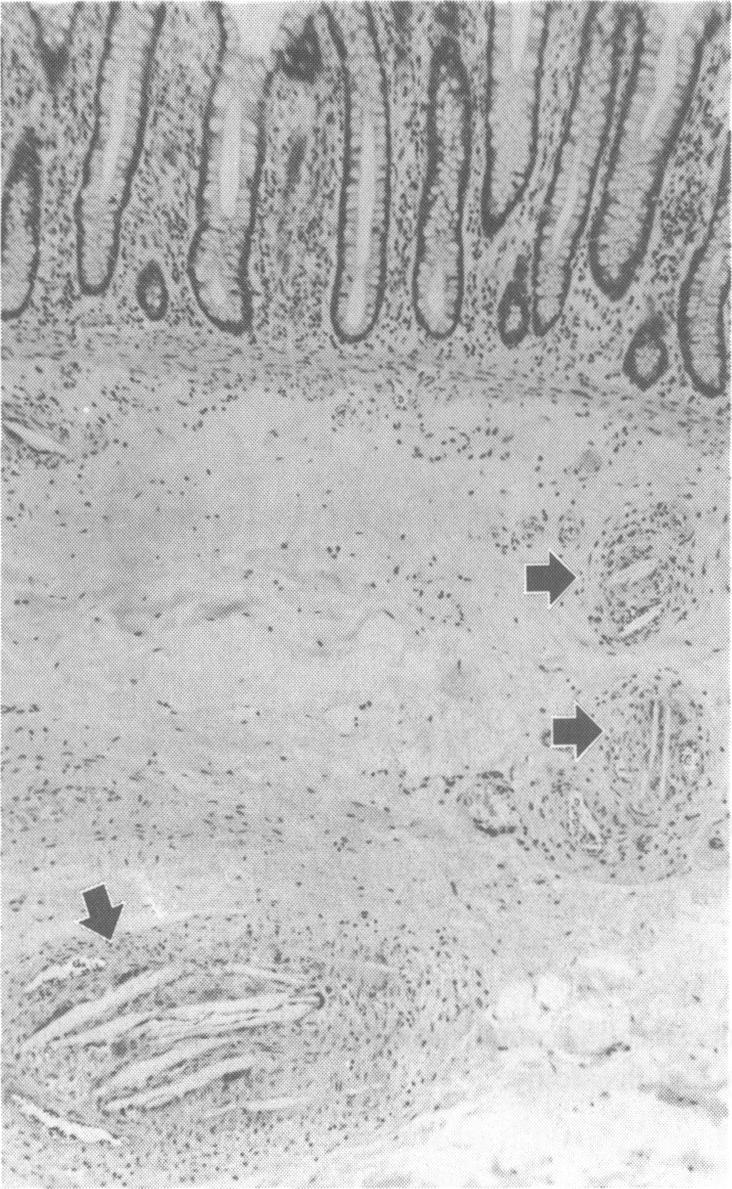 https://cdn.ncbi.nlm.nih.gov/pmc/blobs/48cc/2399660/3ac37a65cbe6/postmedj00052-0070-b.jpg