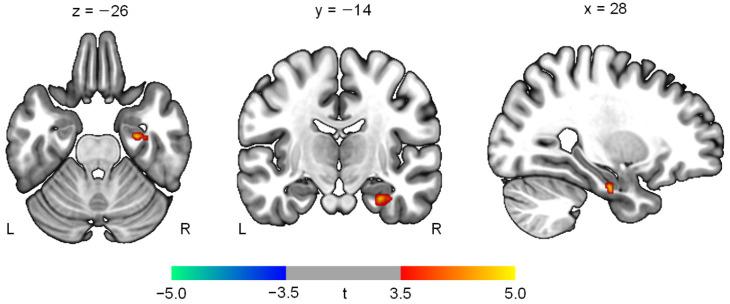 https://cdn.ncbi.nlm.nih.gov/pmc/blobs/48ce/8878180/ca8632bde353/jpm-12-00250-g003.jpg