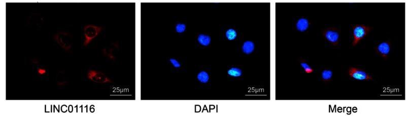 https://cdn.ncbi.nlm.nih.gov/pmc/blobs/48d6/6613355/3d62a0f2019d/CMAR-11-6043-g0005.jpg