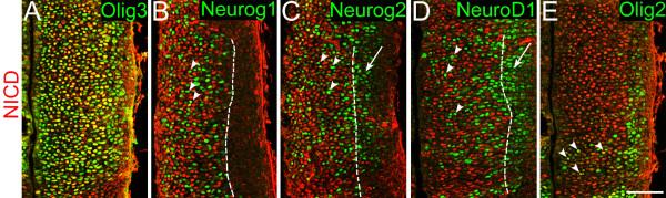 https://cdn.ncbi.nlm.nih.gov/pmc/blobs/48dc/3234181/5ef14c7b661b/1749-8104-6-35-5.jpg