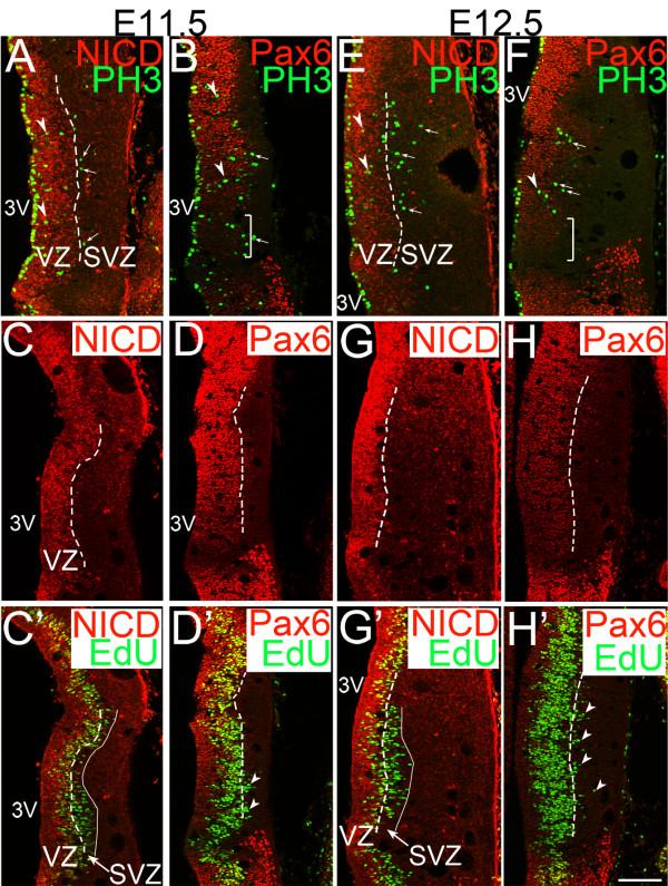 https://cdn.ncbi.nlm.nih.gov/pmc/blobs/48dc/3234181/7035293f6ce1/1749-8104-6-35-2.jpg