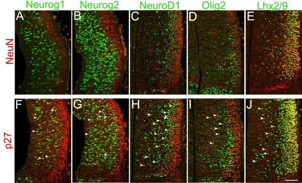 https://cdn.ncbi.nlm.nih.gov/pmc/blobs/48dc/3234181/aab715de26e2/1749-8104-6-35-8.jpg