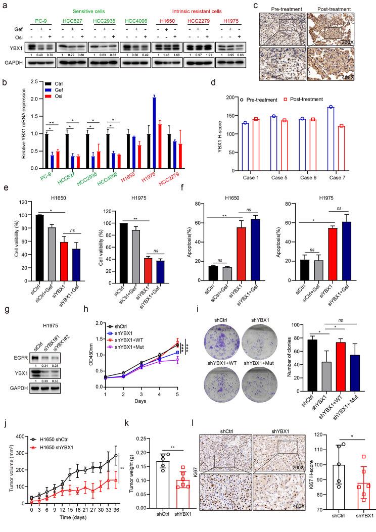 https://cdn.ncbi.nlm.nih.gov/pmc/blobs/48e0/10169458/c6a6879594b6/12943_2023_1780_Fig4_HTML.jpg