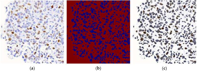 https://cdn.ncbi.nlm.nih.gov/pmc/blobs/48e0/12345923/22a44e20de7a/diagnostics-15-01958-g005.jpg