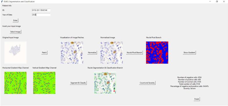 https://cdn.ncbi.nlm.nih.gov/pmc/blobs/48e0/12345923/50d14b54809d/diagnostics-15-01958-g014.jpg