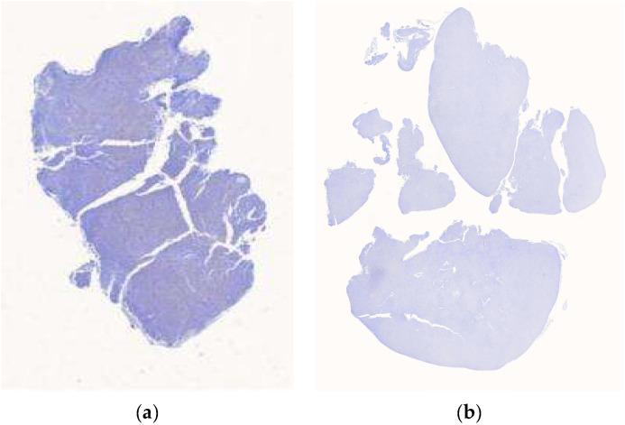 https://cdn.ncbi.nlm.nih.gov/pmc/blobs/48e0/12345923/d11d731a34e5/diagnostics-15-01958-g001.jpg