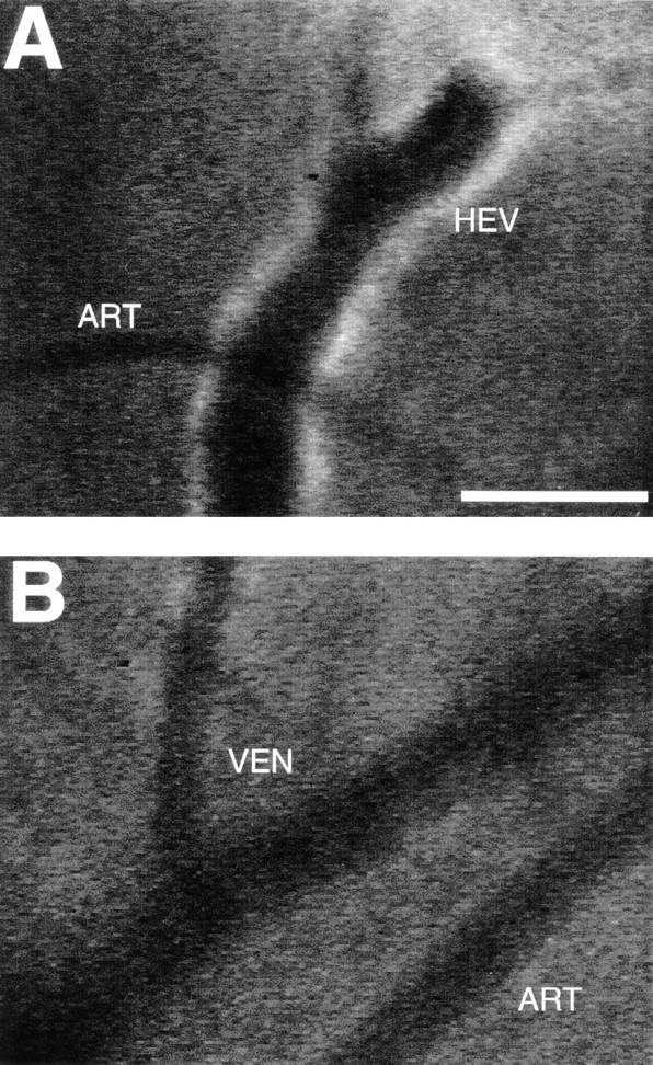 https://cdn.ncbi.nlm.nih.gov/pmc/blobs/48e5/2195804/8585cc04dfa2/JEM990903.f2ab.jpg