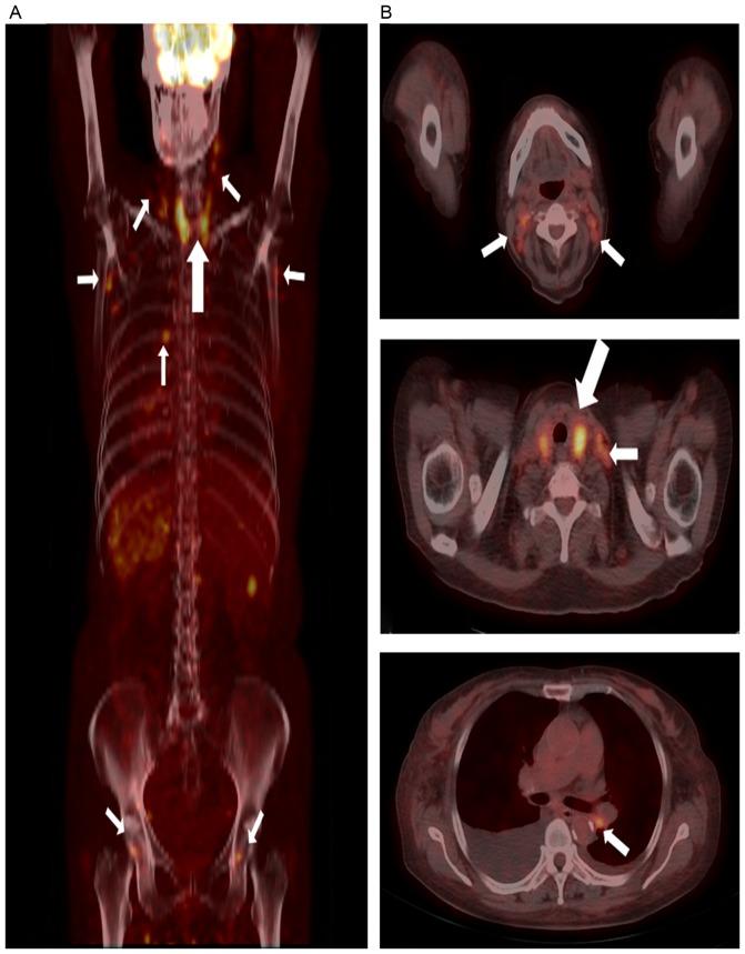 https://cdn.ncbi.nlm.nih.gov/pmc/blobs/48eb/5450601/134c2f23342b/etm-13-06-3369-g00.jpg