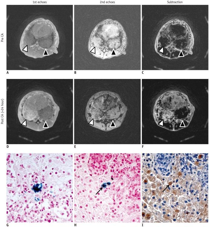 https://cdn.ncbi.nlm.nih.gov/pmc/blobs/48ec/5768497/f4a7ca22baed/kjr-19-153-g001.jpg