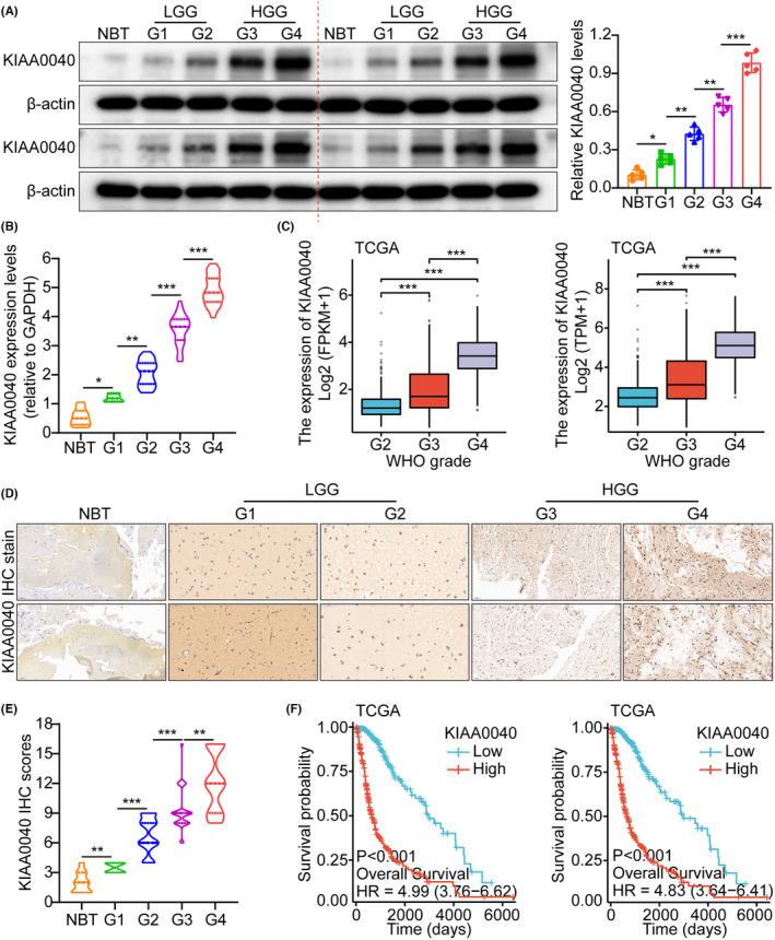 https://cdn.ncbi.nlm.nih.gov/pmc/blobs/48ed/11044867/281965b285ed/JCMM-28-e18332-g005.jpg