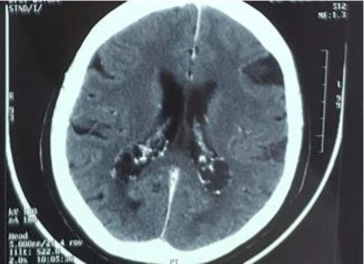 https://cdn.ncbi.nlm.nih.gov/pmc/blobs/48ed/5346303/4cadf62bff80/mehdiophth-5-132-g001.jpg