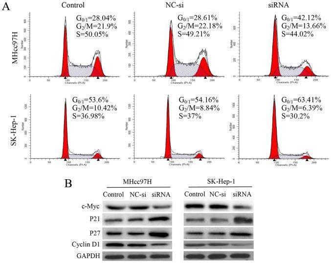 https://cdn.ncbi.nlm.nih.gov/pmc/blobs/48ee/5592886/55d454ebad35/IJO-51-04-1135-g03.jpg