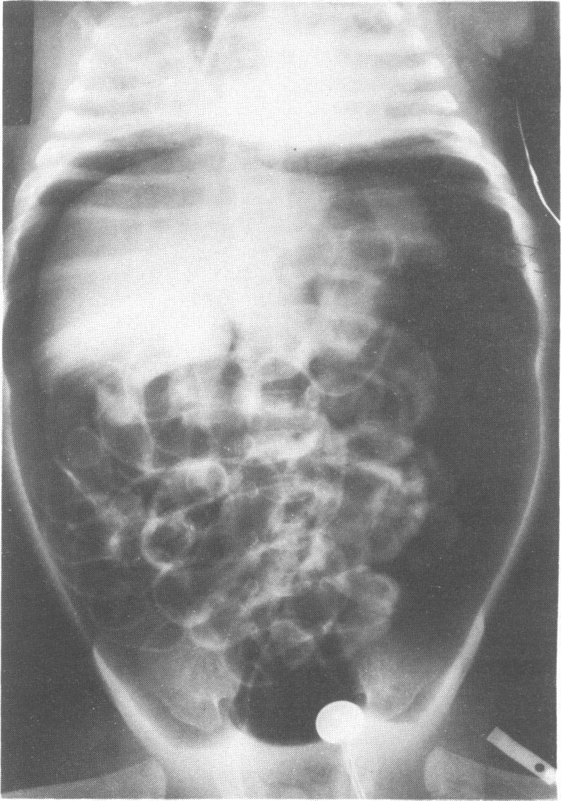 https://cdn.ncbi.nlm.nih.gov/pmc/blobs/48f4/1590277/d66871346463/archdisch00891-0064-a.jpg