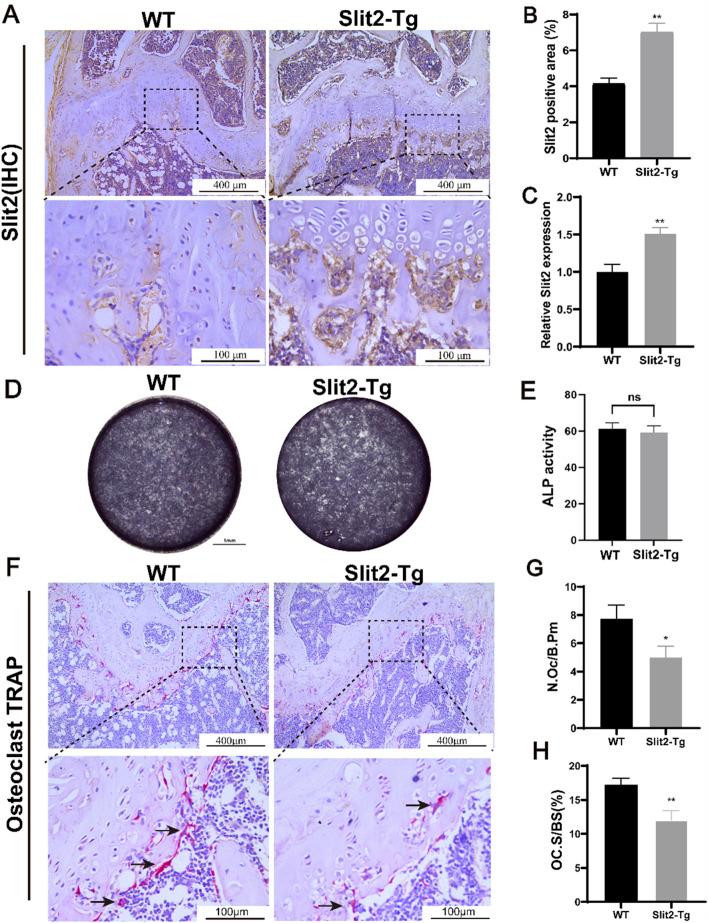 https://cdn.ncbi.nlm.nih.gov/pmc/blobs/48f9/12421006/d0ad1ee0d81b/fcell-13-1632882-g003.jpg