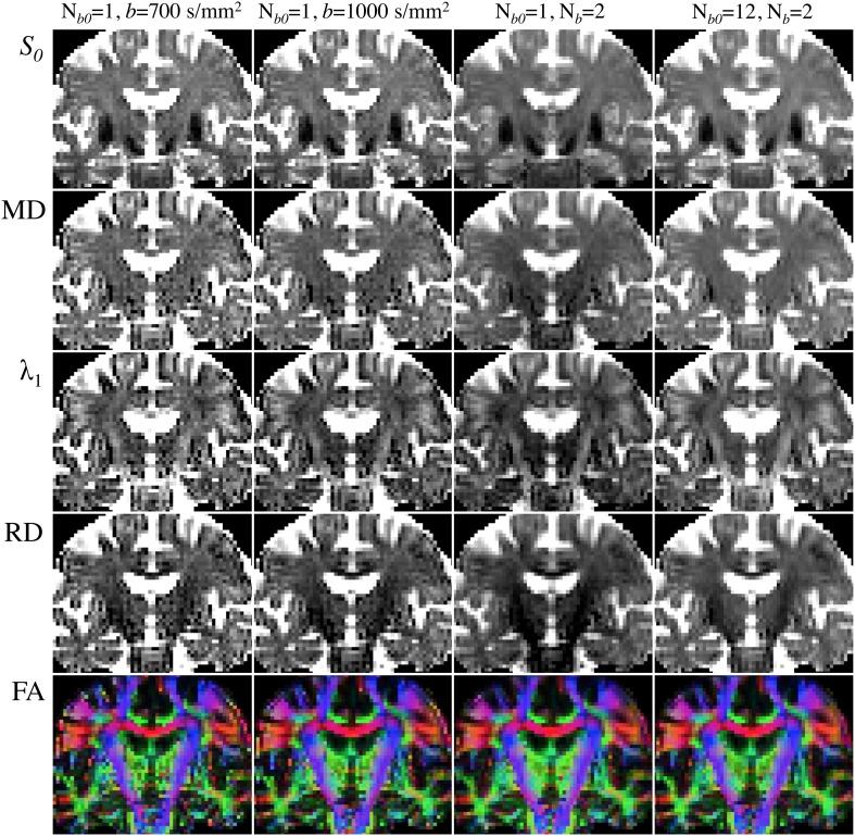 https://cdn.ncbi.nlm.nih.gov/pmc/blobs/48fa/4183111/d7c043e1c87a/fnagi-06-00266-g0006.jpg