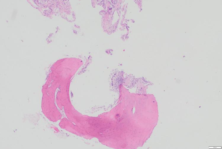 https://cdn.ncbi.nlm.nih.gov/pmc/blobs/4904/12145660/f310994a6faa/cureus-0017-00000083776-i03.jpg