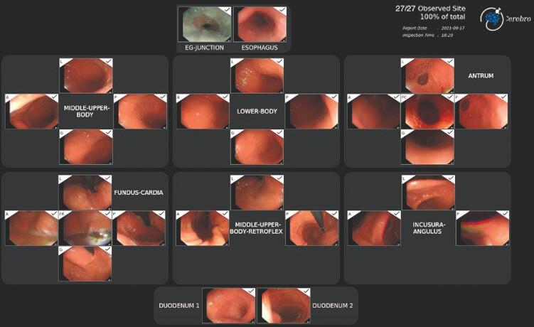 https://cdn.ncbi.nlm.nih.gov/pmc/blobs/4907/12042994/0d1248e5cb7e/10-1055-a-2547-6645_25482535.jpg
